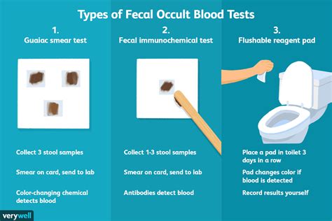 A Comparison of Different Methods for Performing the Stool Occult Blood Detection Test